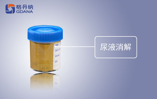 全自動(dòng)石墨消解儀對(duì)尿液中砷、銻的消解方法